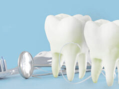 Essential facts about teeth whitening procedures.
