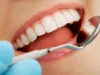 Can you whiten sensitive teeth?